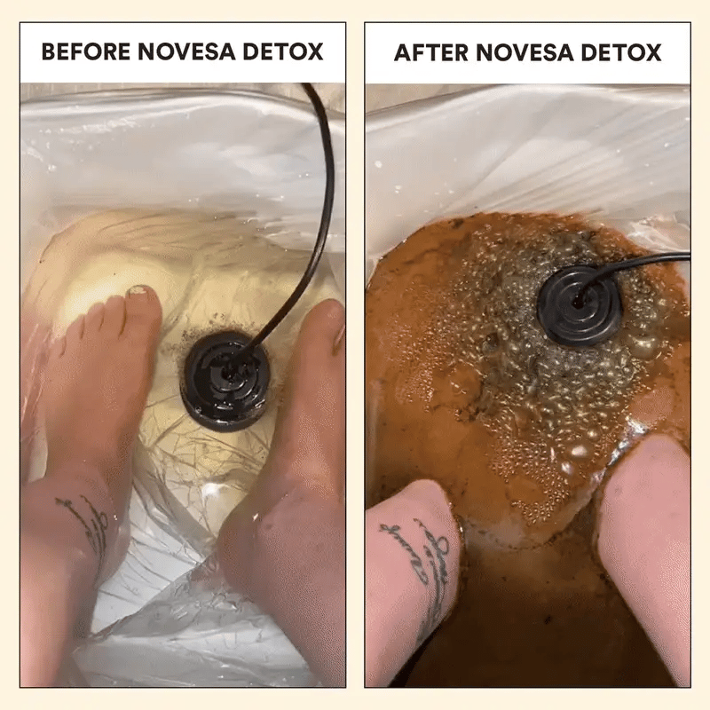 Solevia care® Ionic Foot Bath
