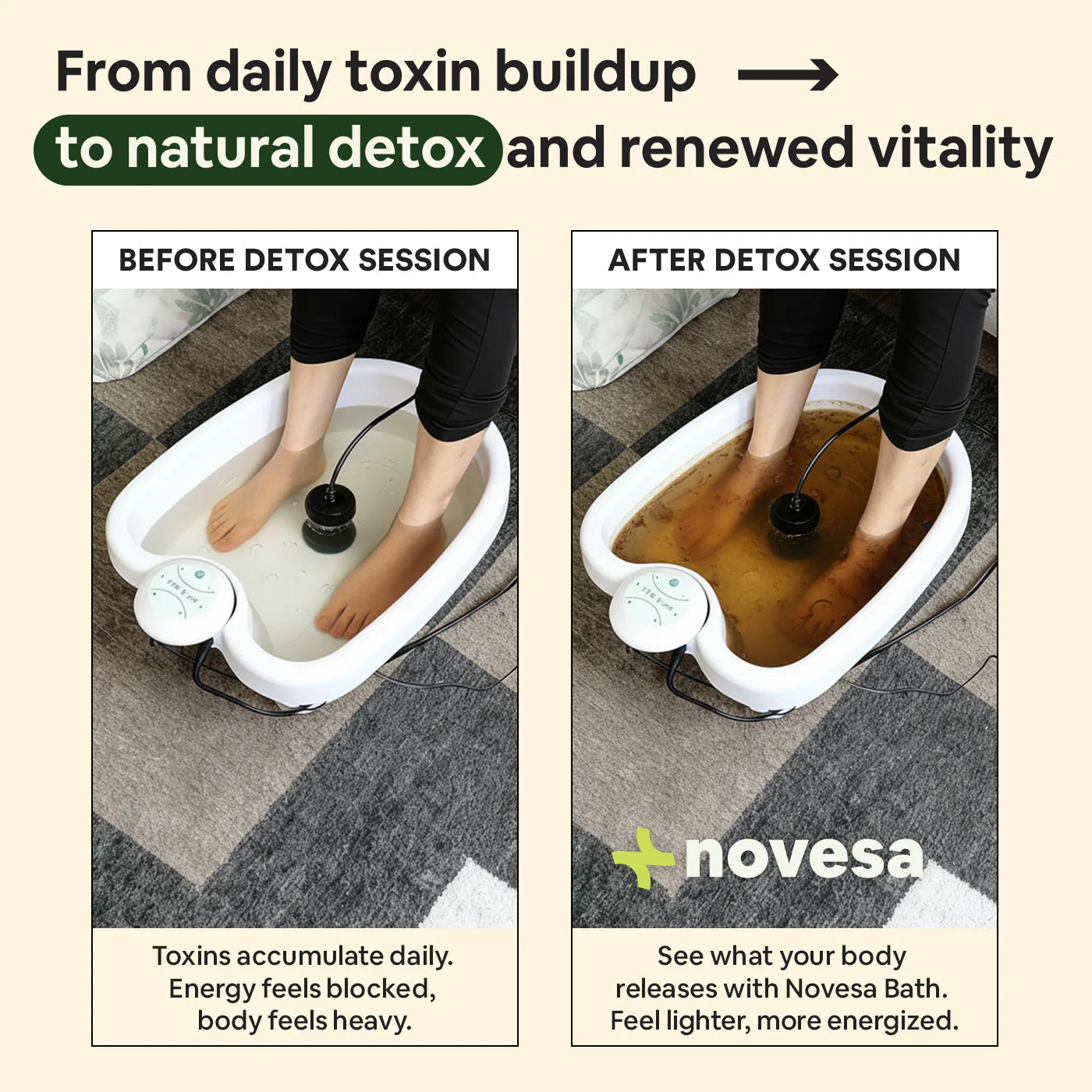Solevia care® Ionic Foot Bath